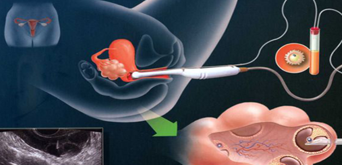 心與肺的關(guān)系從中醫(yī)角度(心與肺在中醫(yī)的關(guān)系是什么)